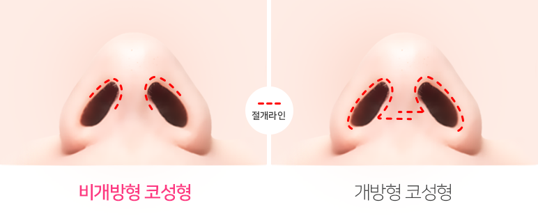 콧대+코끝