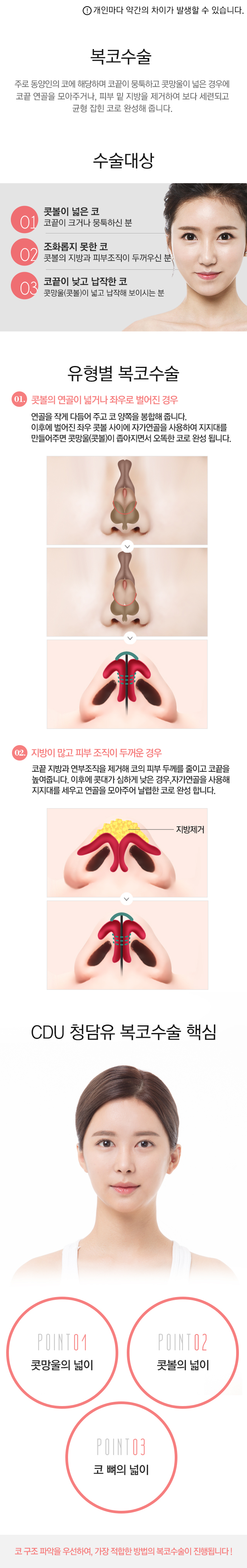 낮은코수술