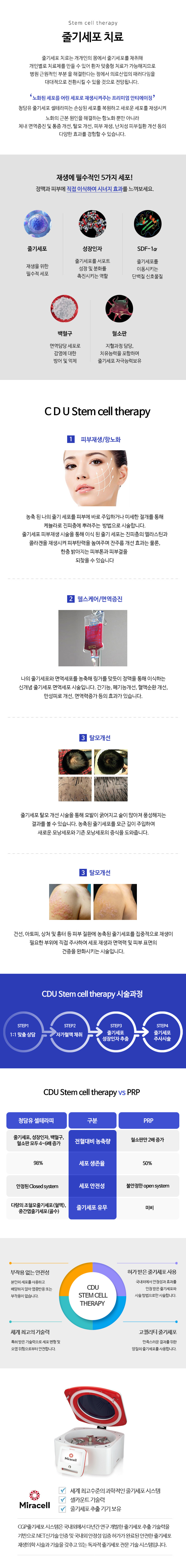 줄기세포치료