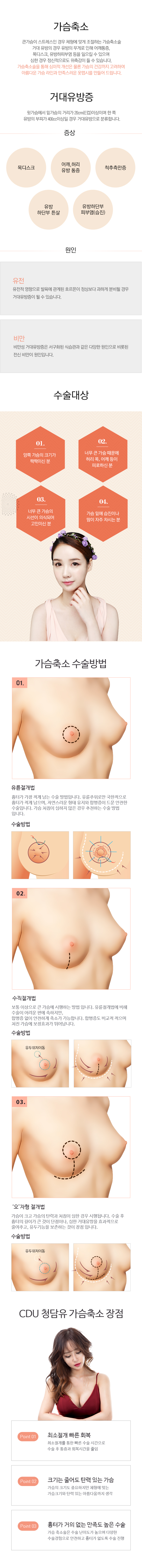 내시경 가슴성형