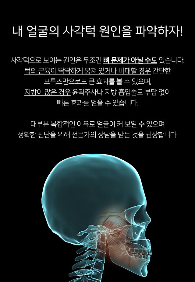 사각턱수술